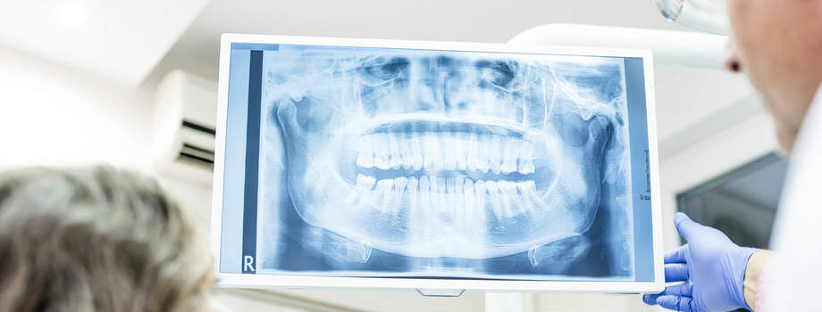 Digital Dental Xrays