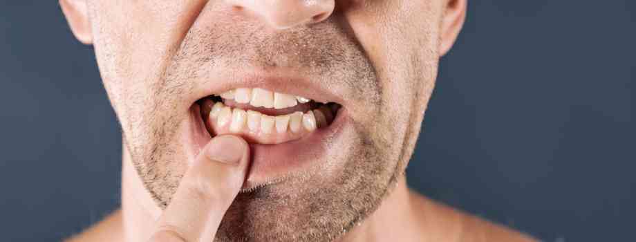 Signs Of Gum Disease