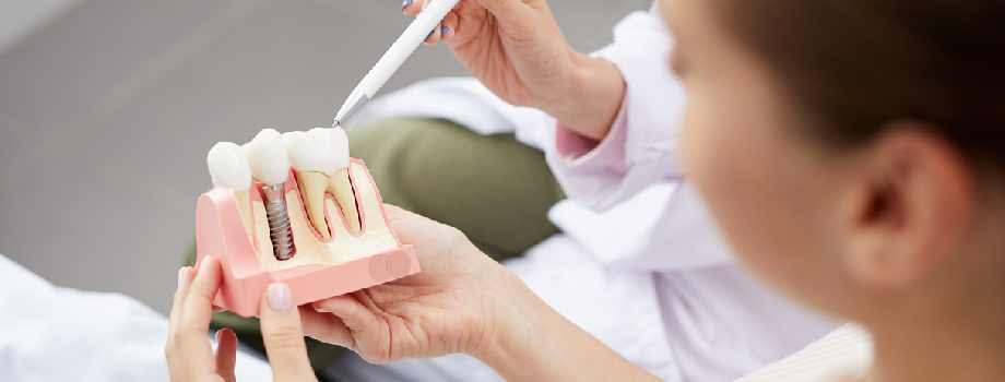 The Benefits of Replacing a Missing Tooth with a Dental Implant