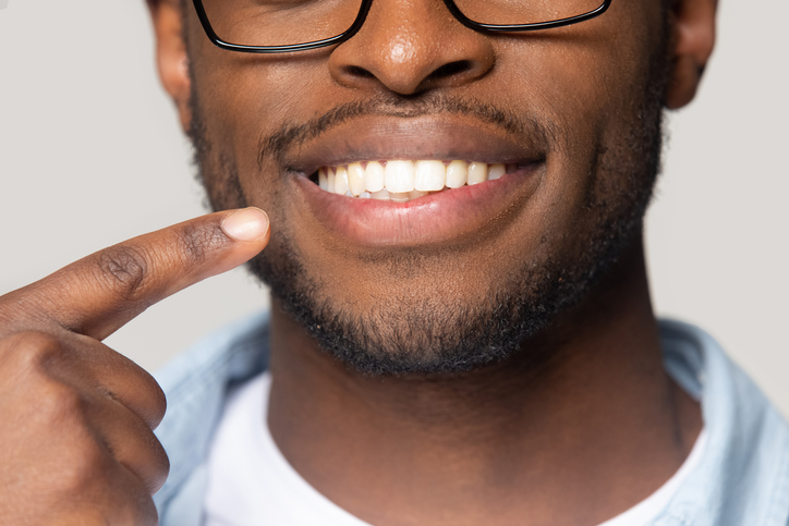 African American guy pointing finger to new smile with dental implants.